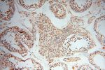 PDH E1 alpha Antibody in Immunohistochemistry (Paraffin) (IHC (P))