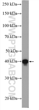 PDH E1 alpha Antibody in Western Blot (WB)