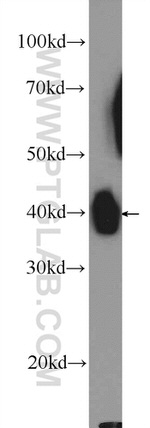 PDH E1 alpha Antibody in Western Blot (WB)