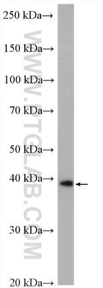 PDH E1 alpha Antibody in Western Blot (WB)