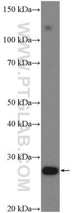 HOXA6 Antibody in Western Blot (WB)