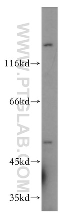 CYP3A4 Antibody in Western Blot (WB)