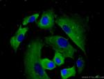 MMP28 Antibody in Immunocytochemistry (ICC/IF)