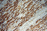 MMP28 Antibody in Immunohistochemistry (Paraffin) (IHC (P))