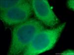 HSP27 Antibody in Immunocytochemistry (ICC/IF)