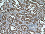 HSP27 Antibody in Immunohistochemistry (Paraffin) (IHC (P))