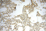 MEF2C Antibody in Immunohistochemistry (Paraffin) (IHC (P))