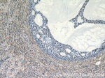 ANGPTL4 Antibody in Immunohistochemistry (Paraffin) (IHC (P))