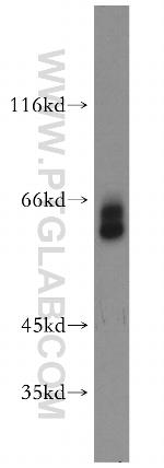 PSAP Antibody in Western Blot (WB)