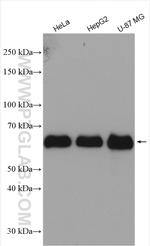 P62/SQSTM1 Polyclonal Antibody (18420-1-AP)