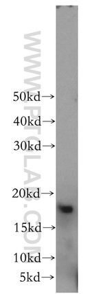 GABARAPL1 Antibody in Western Blot (WB)