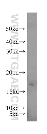 GABARAPL1 Antibody in Western Blot (WB)