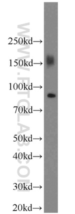 CD36 Antibody in Western Blot (WB)