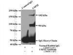 USP32 Antibody in Immunoprecipitation (IP)