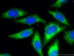 iNOS Antibody in Immunocytochemistry (ICC/IF)