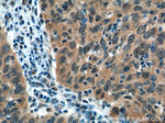 EGFR Antibody in Immunohistochemistry (Paraffin) (IHC (P))