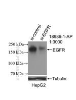 EGFR Antibody in Western Blot (WB)