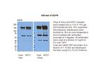 EGFR Antibody in Western Blot (WB)