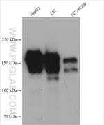 EGFR Antibody in Western Blot (WB)