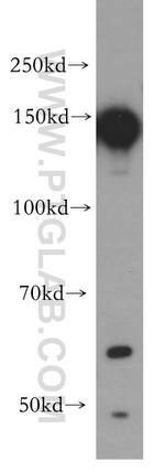 EGFR Antibody in Western Blot (WB)