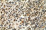 IKZF3 Antibody in Immunohistochemistry (Paraffin) (IHC (P))