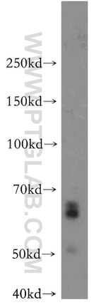 IKZF3 Antibody in Western Blot (WB)