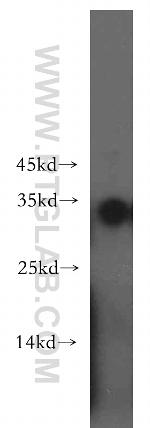 NAT1 Antibody in Western Blot (WB)