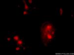 SPIN1 Antibody in Immunocytochemistry (ICC/IF)