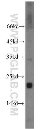 TMEM176B Antibody in Western Blot (WB)