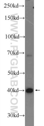 hIST1 Antibody in Western Blot (WB)