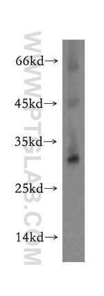 TMEM38A Antibody in Western Blot (WB)