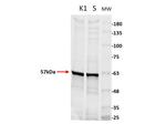 Pyruvate Kinase Antibody in Western Blot (WB)