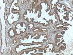 MUC16/CA125 Antibody in Immunohistochemistry (Paraffin) (IHC (P))