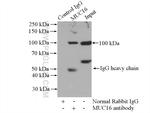 MUC16/CA125 Antibody in Immunoprecipitation (IP)