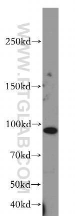 MUC16/CA125 Antibody in Western Blot (WB)