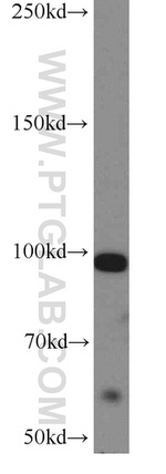 MUC16/CA125 Antibody in Western Blot (WB)