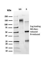 ZBTB7C/KR-POK Antibody in SDS-PAGE (SDS-PAGE)