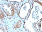 TIGIT/VSTM3/VSIG9 (Immune Checkpoint for Cancer) Antibody in Immunohistochemistry (Paraffin) (IHC (P))