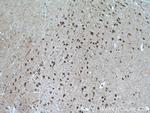 UNC5C Antibody in Immunohistochemistry (Paraffin) (IHC (P))