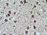 UNC5C Antibody in Immunohistochemistry (Paraffin) (IHC (P))