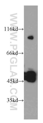 UNC5C Antibody in Western Blot (WB)