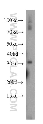 PLEKHF1 Antibody in Western Blot (WB)