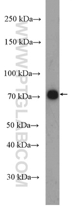 SLC11A2 Antibody in Western Blot (WB)