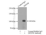 DDX58 Antibody in Immunoprecipitation (IP)