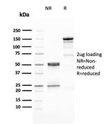 HER-2/c-erbB-2/neu/CD340 Antibody in SDS-PAGE (SDS-PAGE)