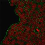 HER-2/c-erbB-2/neu/CD340 Antibody in Immunocytochemistry (ICC/IF)