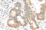 POLR2A Antibody in Immunohistochemistry (Paraffin) (IHC (P))