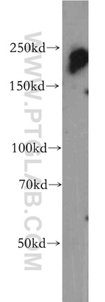 POLR2A Antibody in Western Blot (WB)