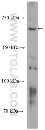 POLR2A Antibody in Western Blot (WB)