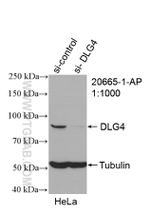 PSD95/DLG4 Antibody in Western Blot (WB)